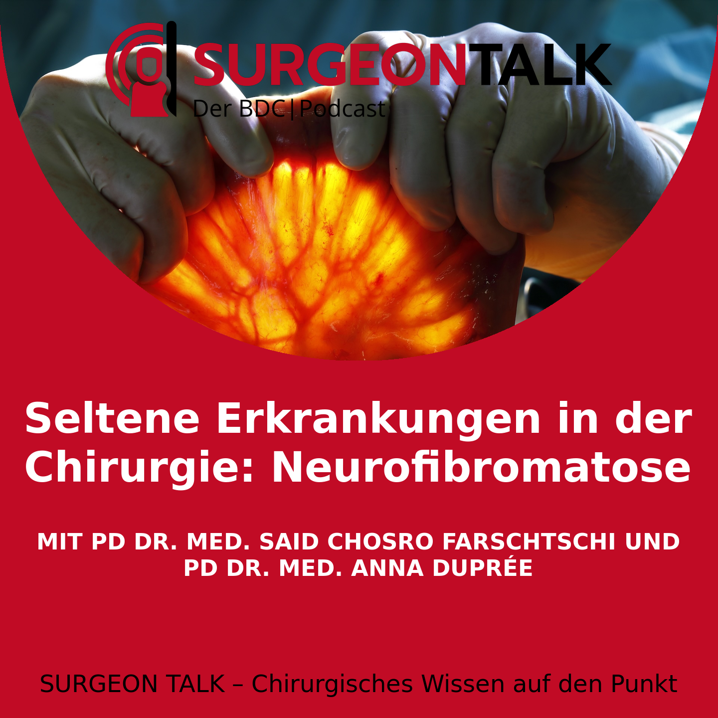 SURGEON TALK